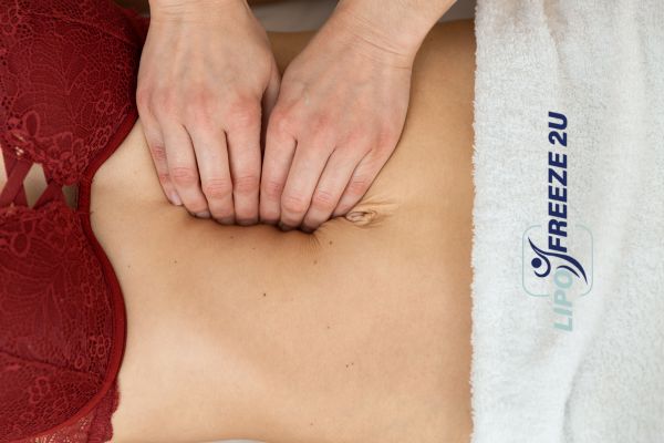 diastasis recti treatment Skegness