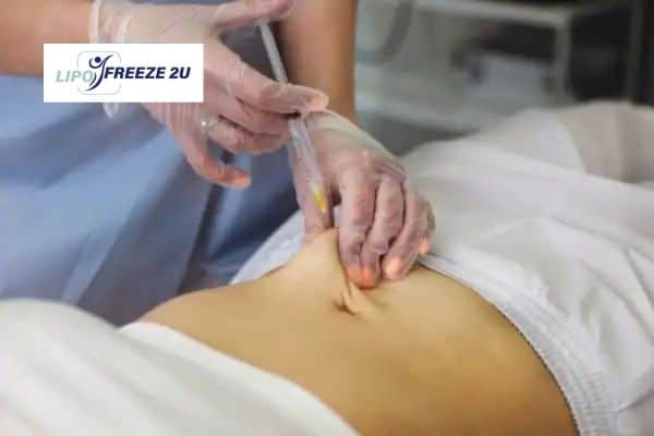 How Does Aqualyx Fat Dissolving Injection Work to Break Down Fat Skegness?
