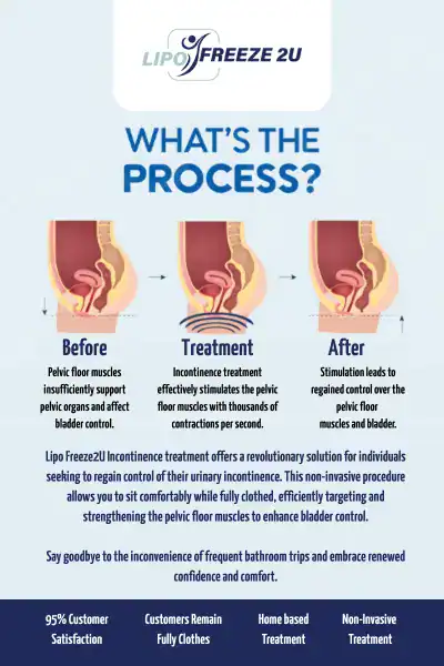 Diagram of how incontinence treatment Skegness works.