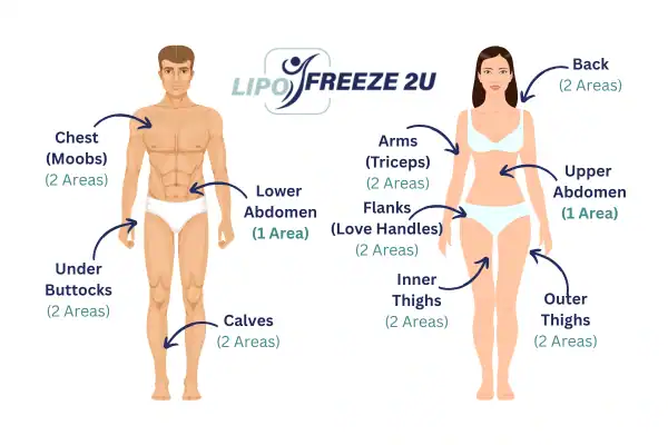 Areas you can have fat freezing treatment Skegness