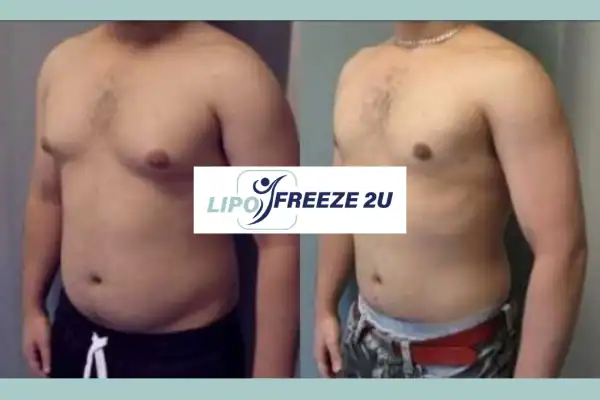 How Long Does It Take to See Results Skegness?