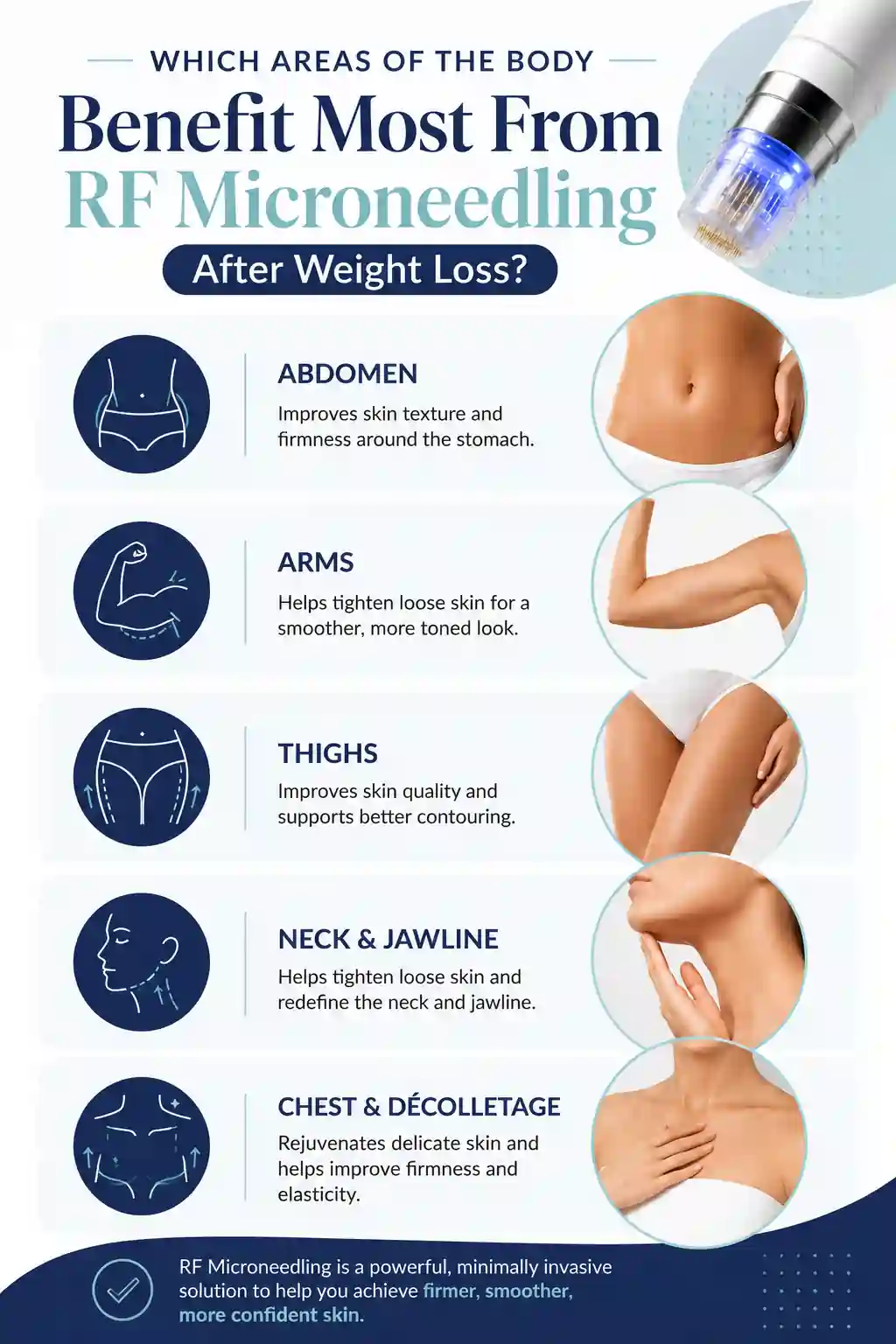 Which Areas of the Body Benefit Most From RF Microneedling After Weight Loss Skegness
