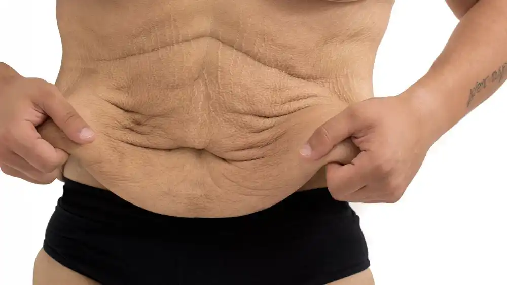 RF Microneedling for Loose Skin: How Can It Help Tighten and Reshape the Skin Skegness?